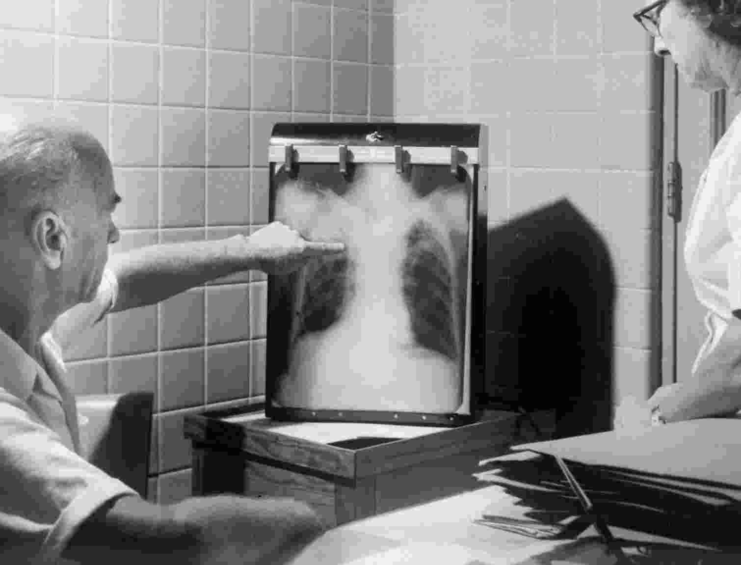 Inhibiting unusual form of cell death could help with lung damage treatment in Covid patients, Columbia University research reveals