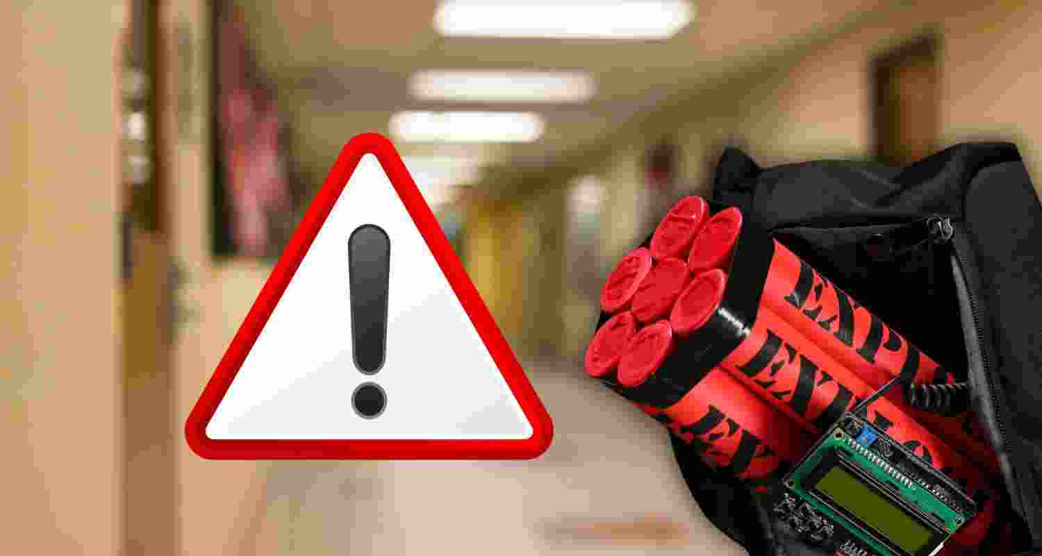 Representative Image. 