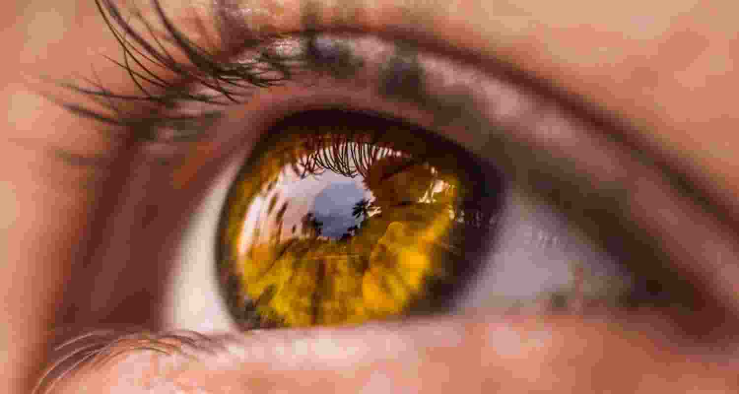 Representative Image. 