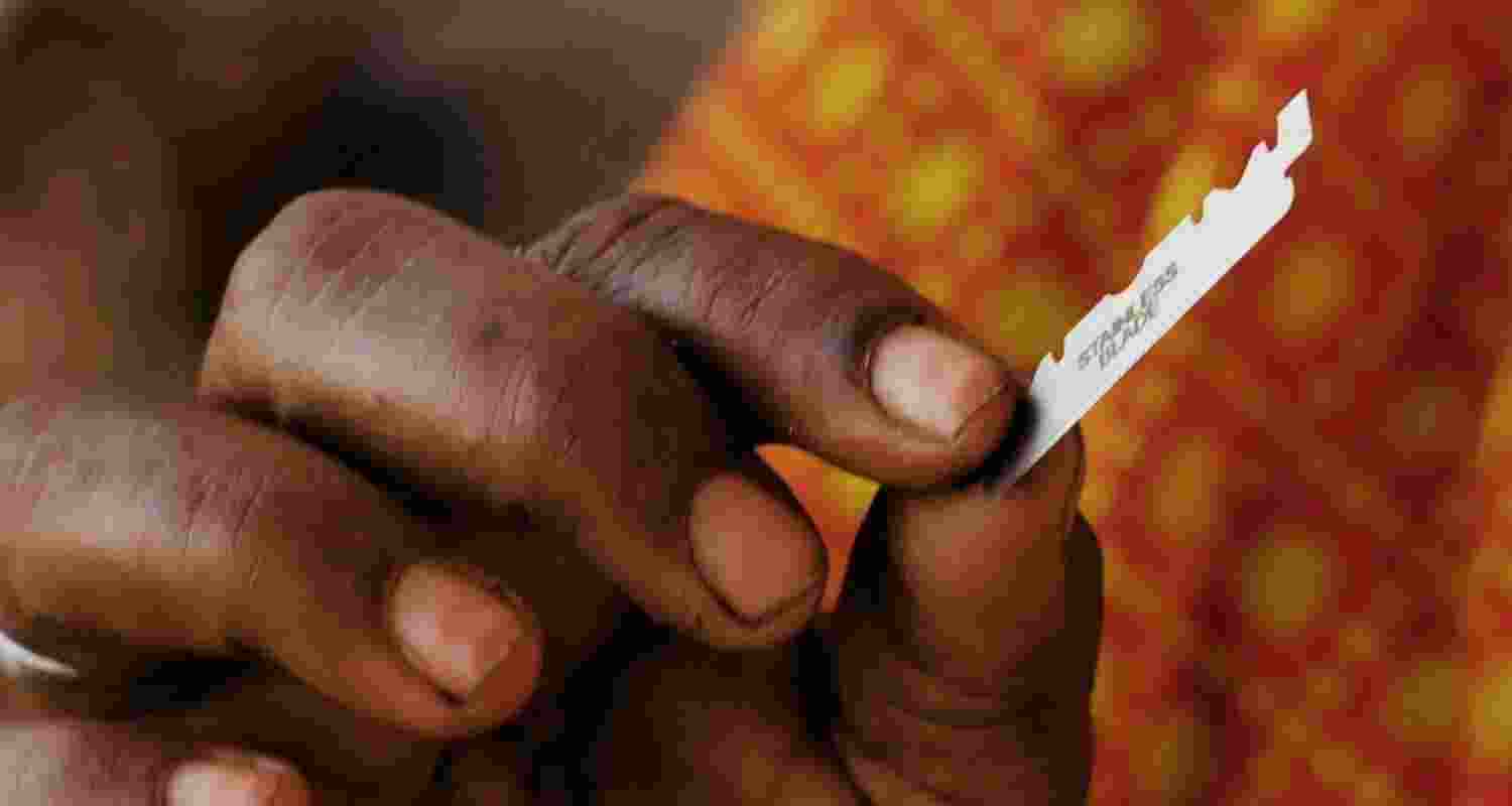 Often performed on girls before they hit puberty, FGM is a cruel and inhuman practice involving partial or total removal of the female genitalia, and known to be practised in parts of Africa, Middle East and Asia for religious or traditional beliefs