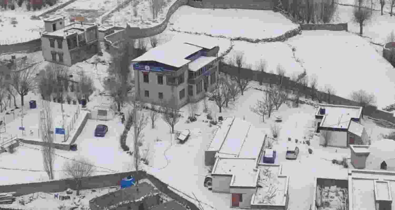 Representative Image. 