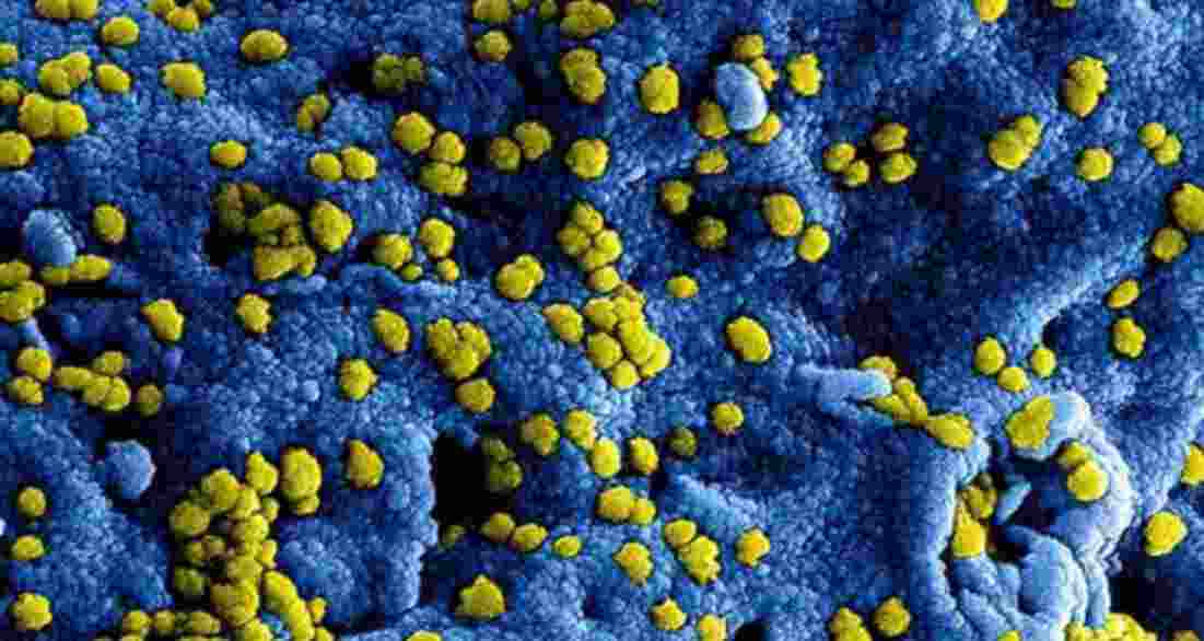 CCMB finds metabolic trigger behind deadly fungal infections