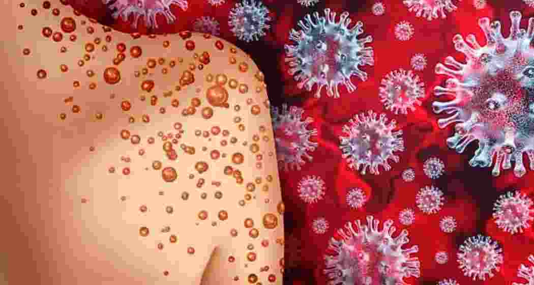 Image for representative use only.