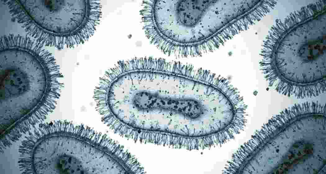 Image for representative use only. Image for representative use only.