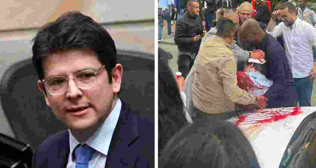 Senator Miguel Uribe Turbay was seriously wounded in a shooting in Bogotá on Friday during a campaign event. Authorities have arrested a suspect and launched a full investigation. Senator Miguel Uribe Turbay was seriously wounded in a shooting in Bogotá on Friday during a campaign event. Authorities have arrested a suspect and launched a full investigation.