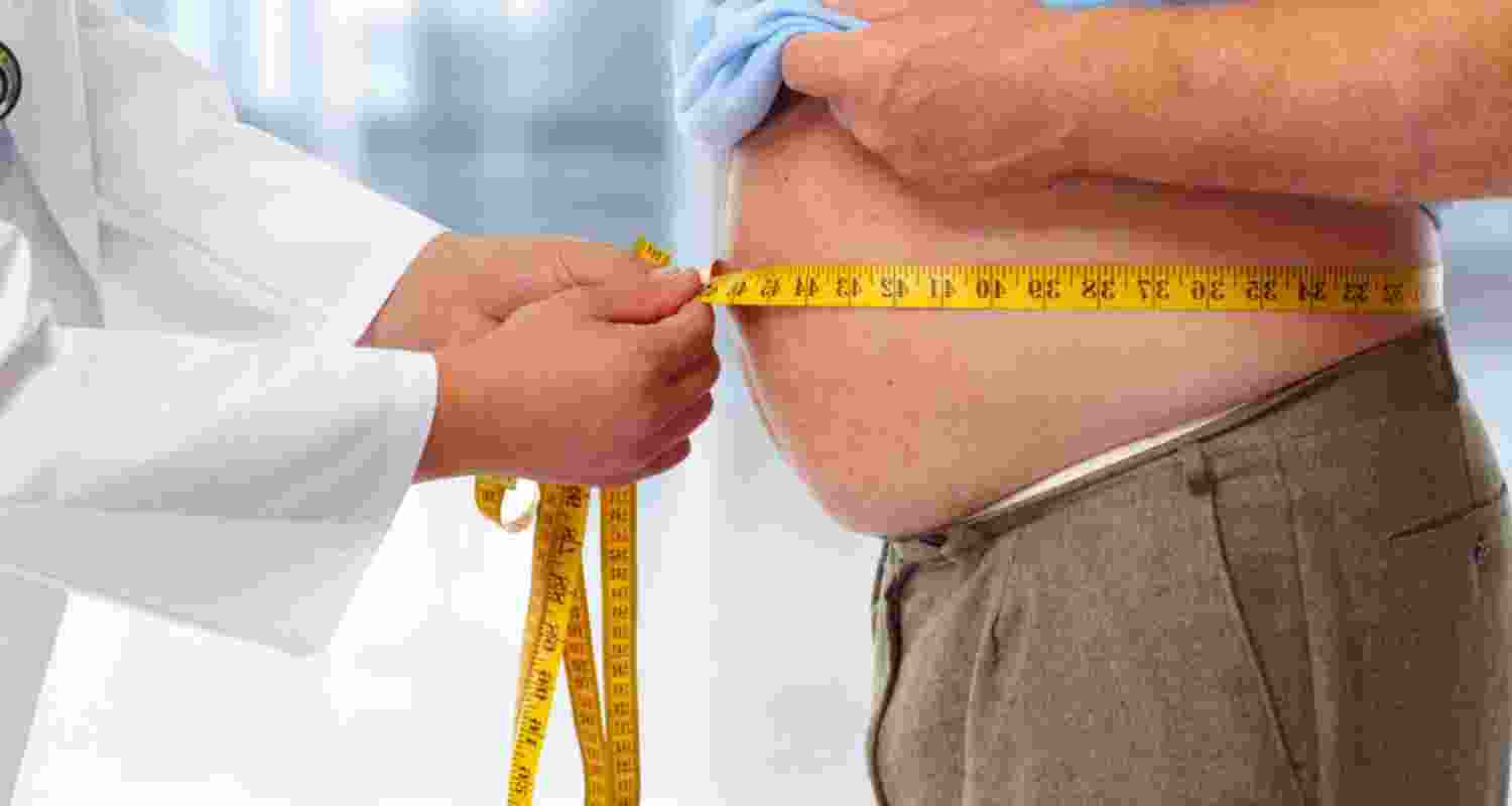 Is obesity a disease? Debate stirs in modern medicine
Is obesity a disease? Debate stirs in modern medicine