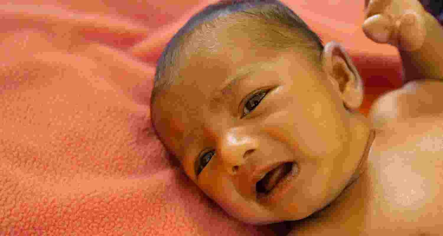 Representative Image. 