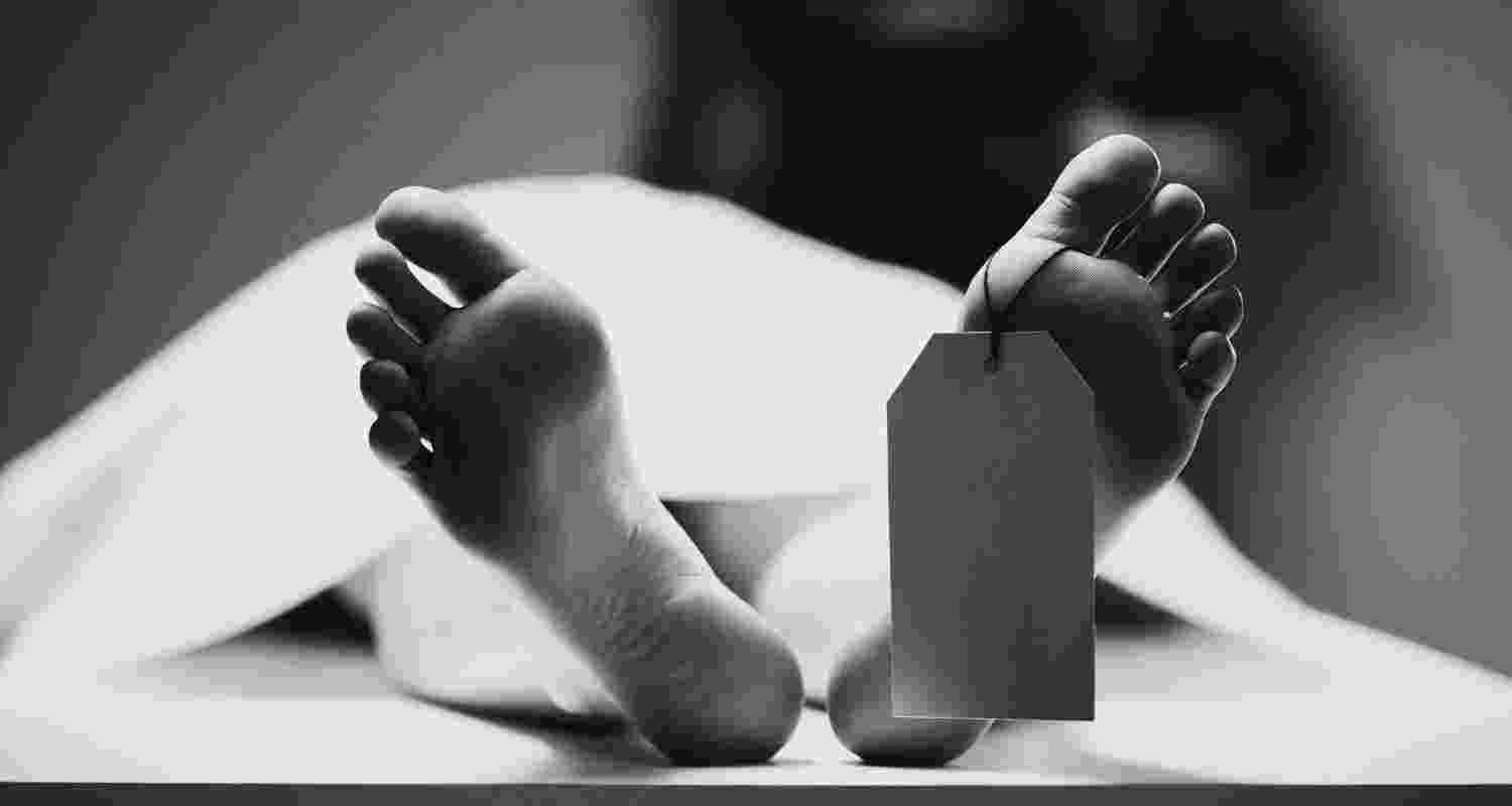 Representative Image. 