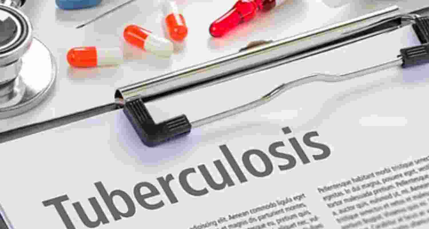 121 people died of tuberculosis in Mizoram since January 121 people died of tuberculosis in Mizoram since January