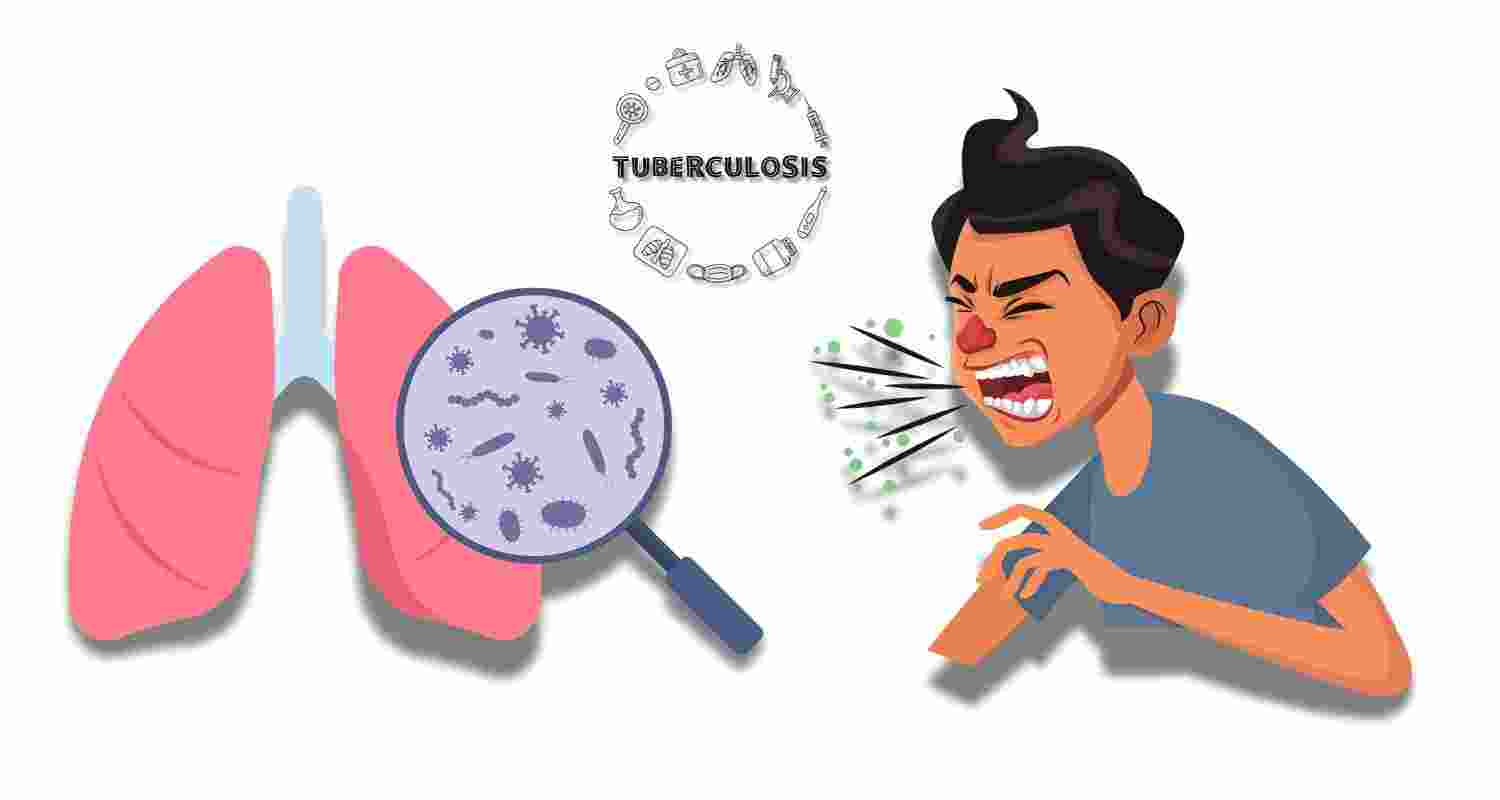 Representative Image. Representative Image.