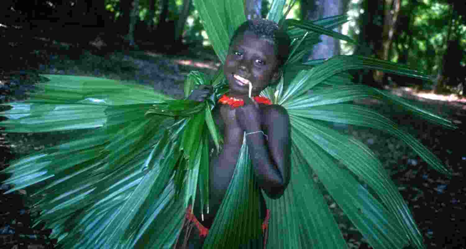 Representational image.