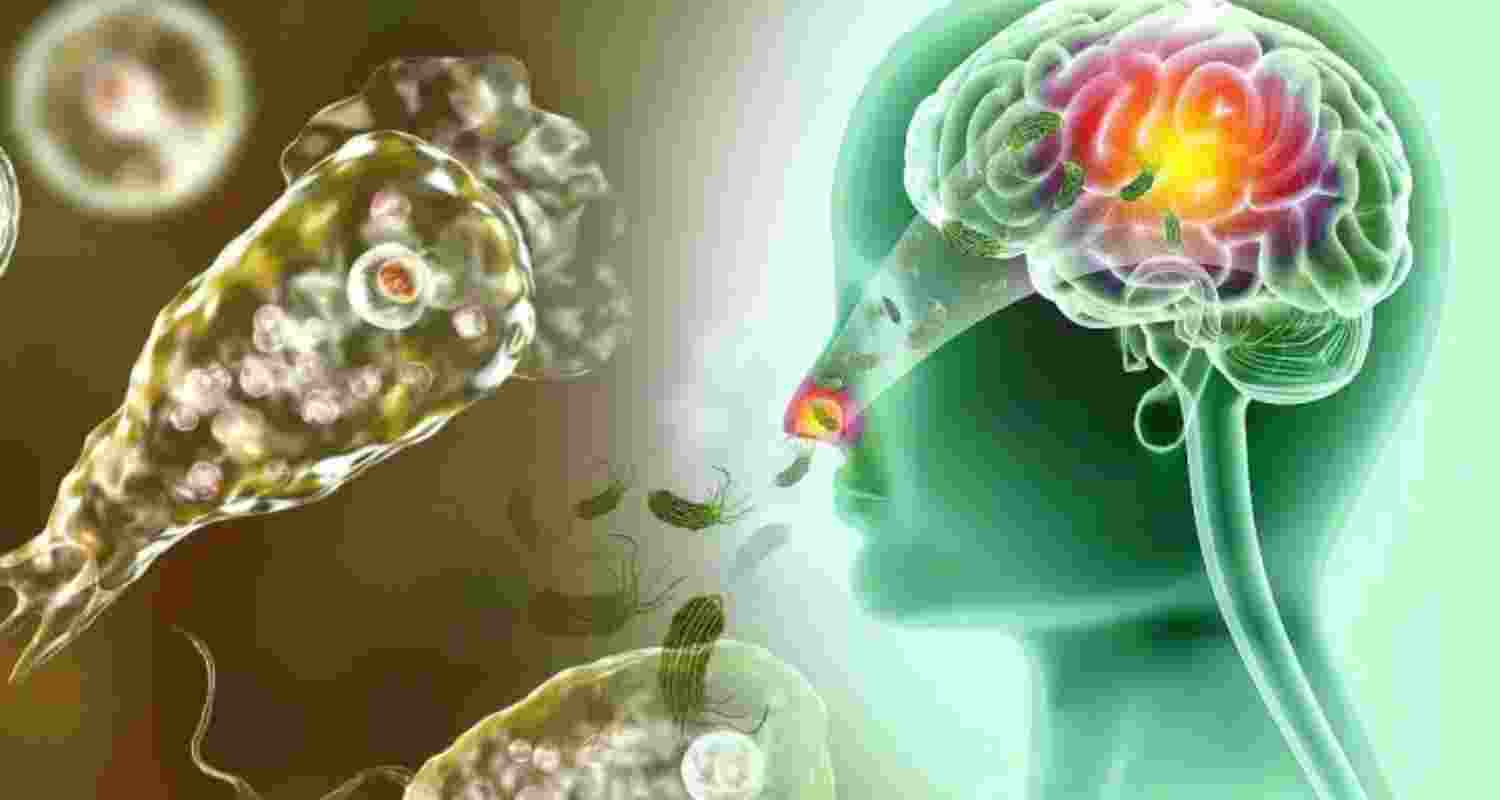 ICMR to study surge in amoebic infection cases in Kerala