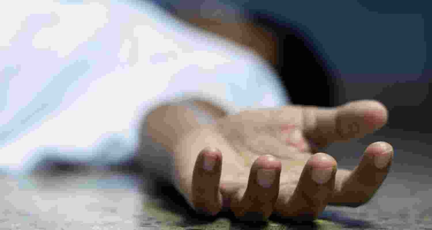 Representative image