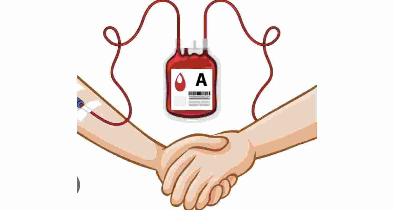 Represntational image.