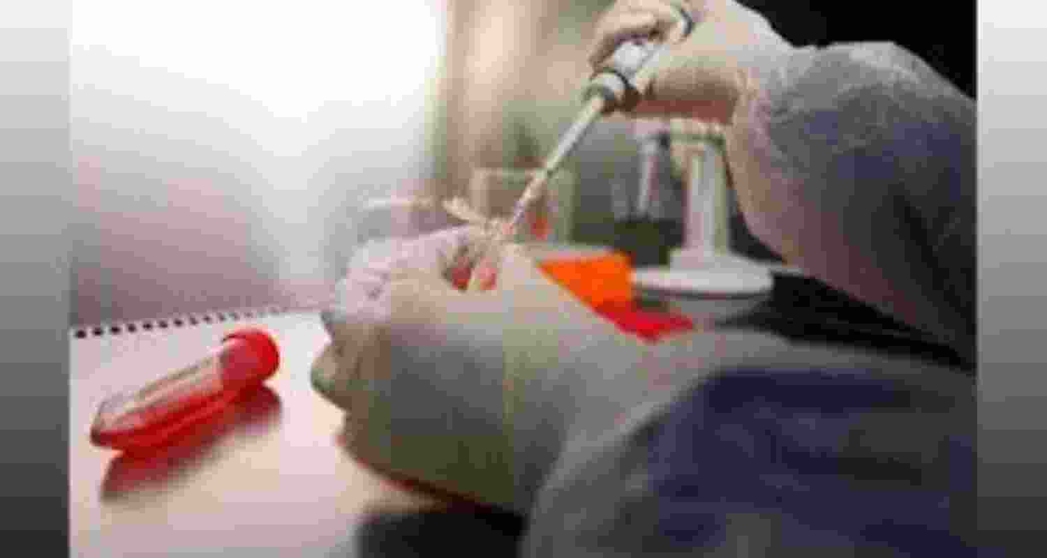 Representative Image Representative Image