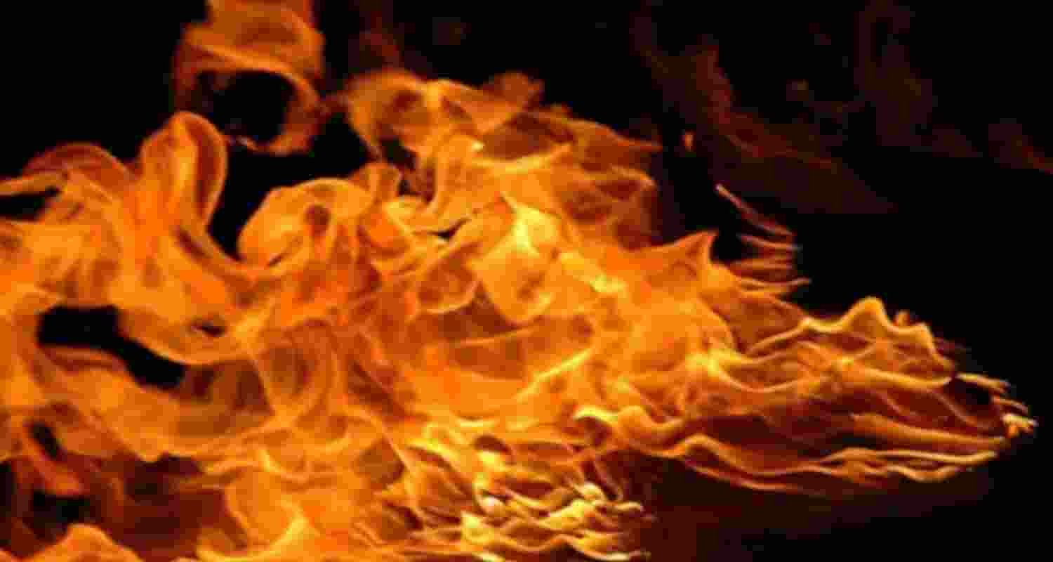 Representational image.