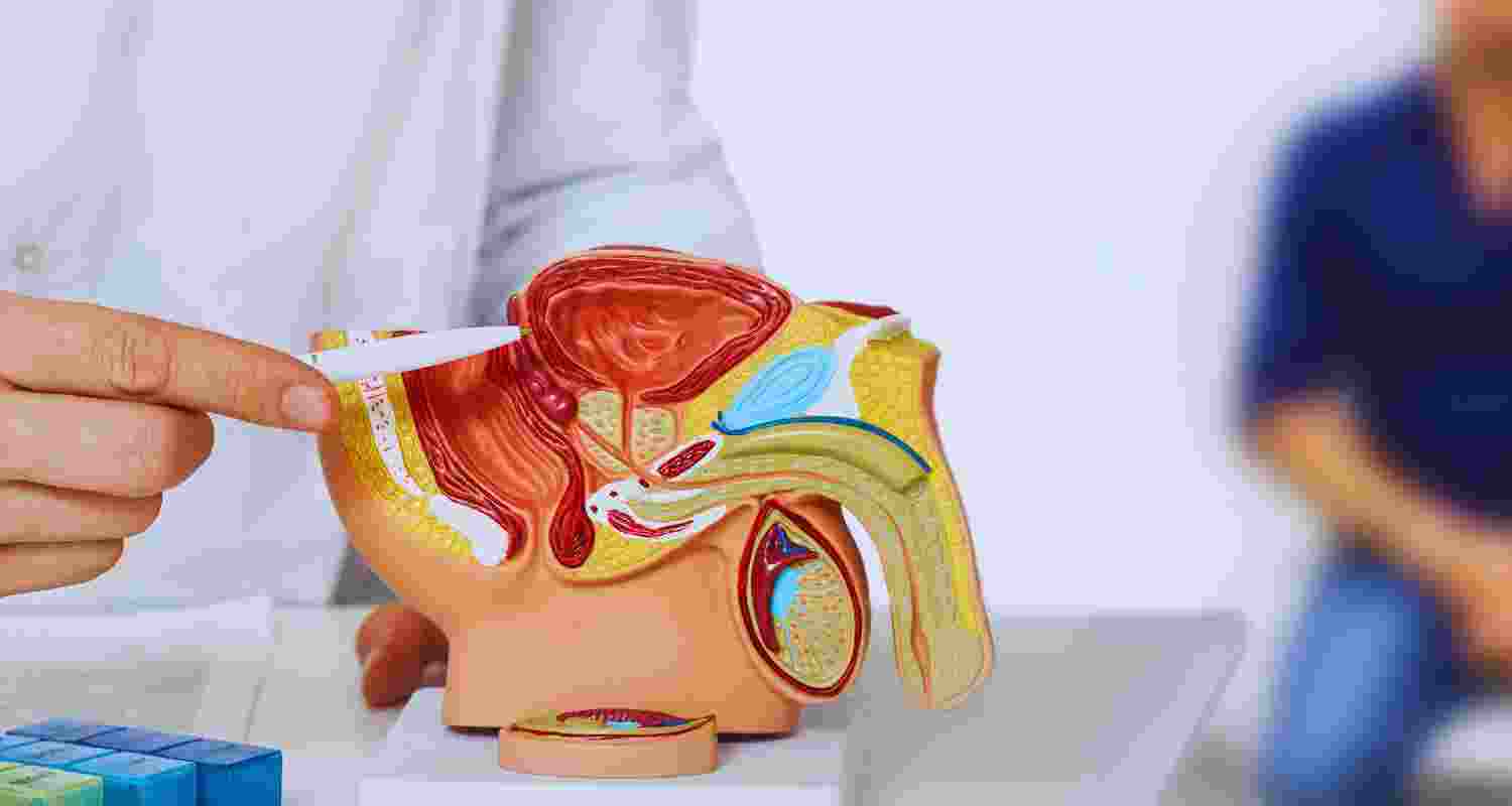 What is Prostate cancer? Is it curable? What is Prostate cancer? Is it curable?