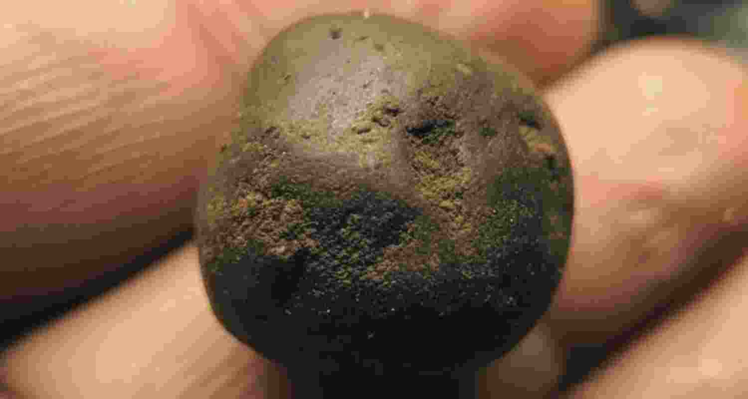 Representative Image. 