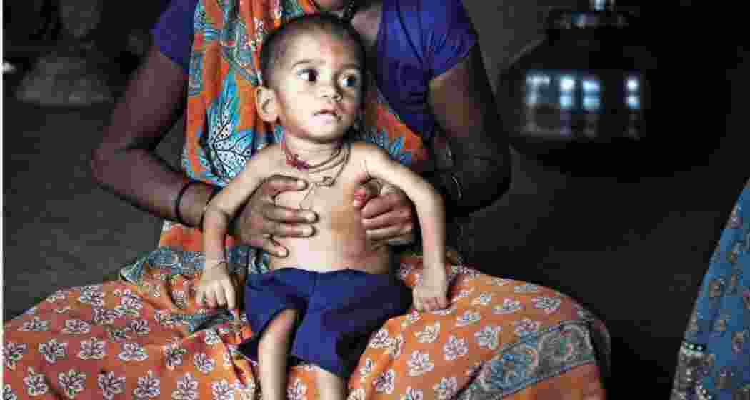 Representational image.