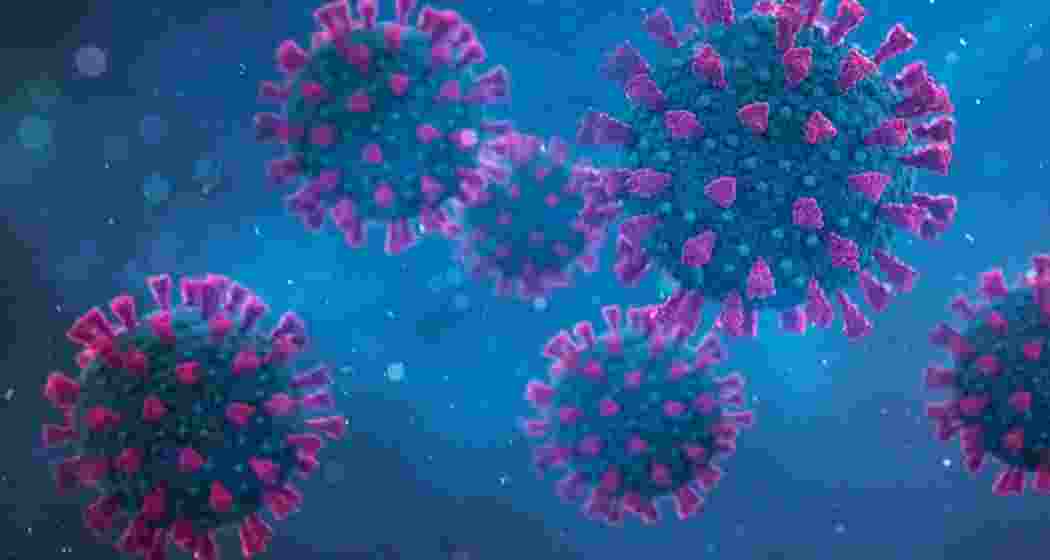 Representative use only.