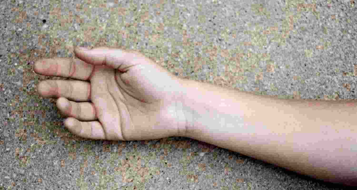 Representative image.