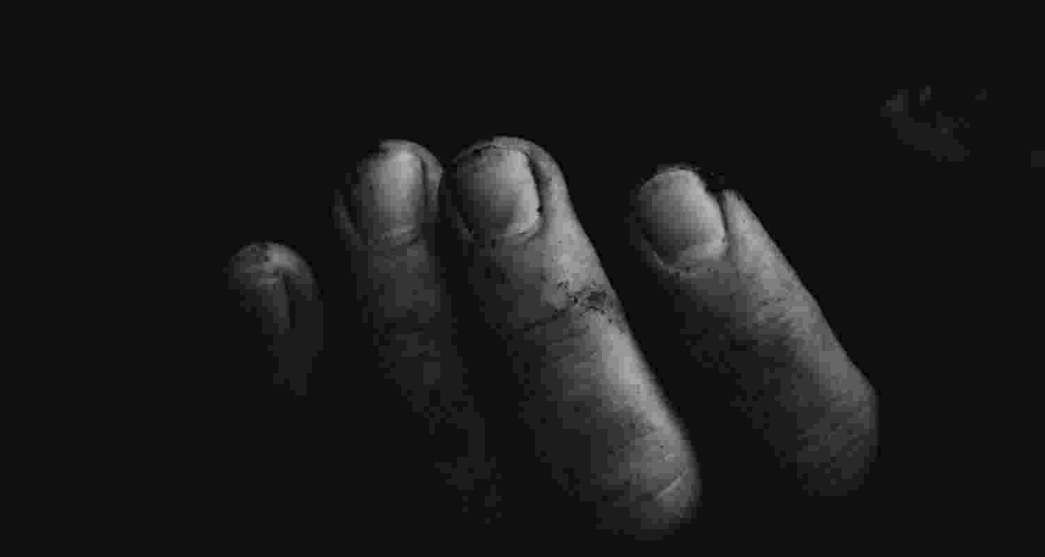 Representative Image. 