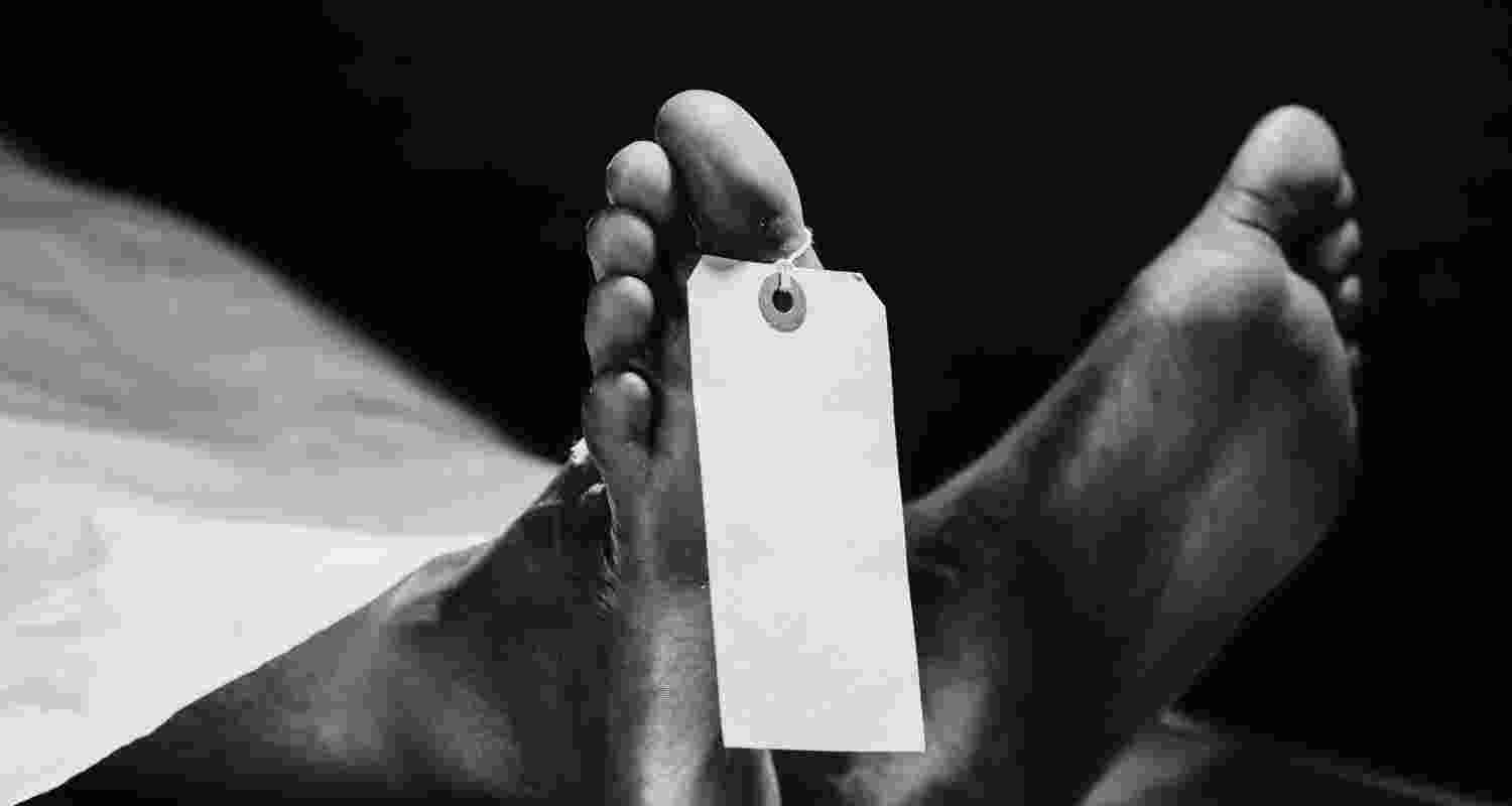 Representative Image. 