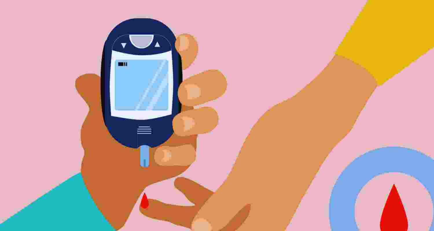 Representative Image. 