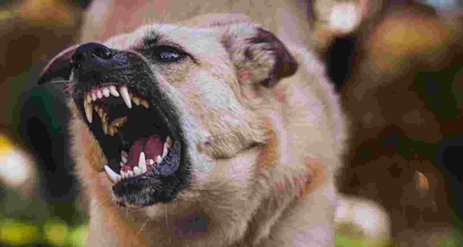 Representative Image. 