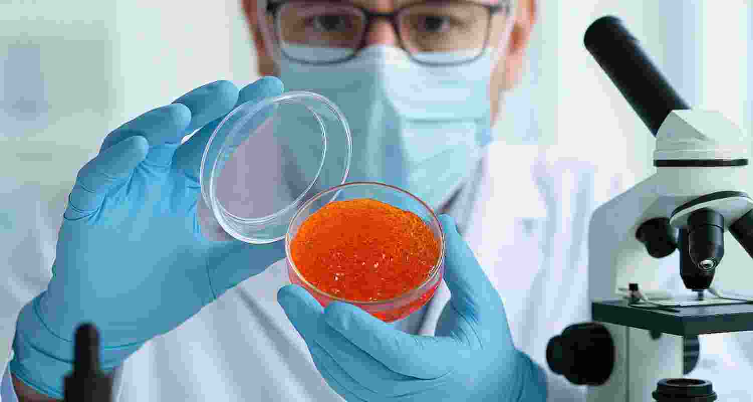 Representational image.