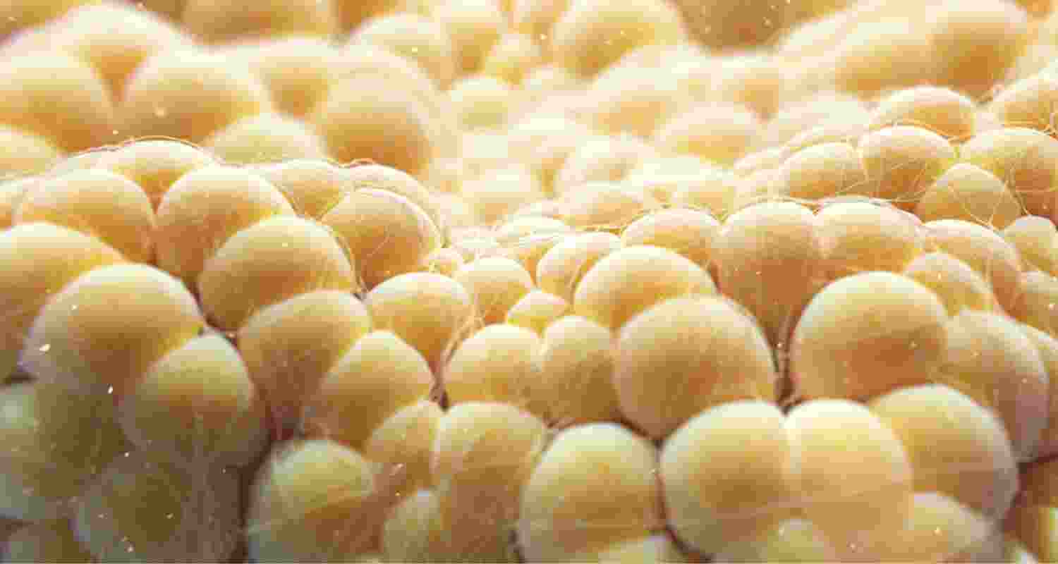 How fat cells could burn away obesity