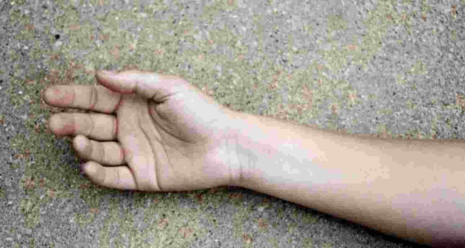 Representational image.