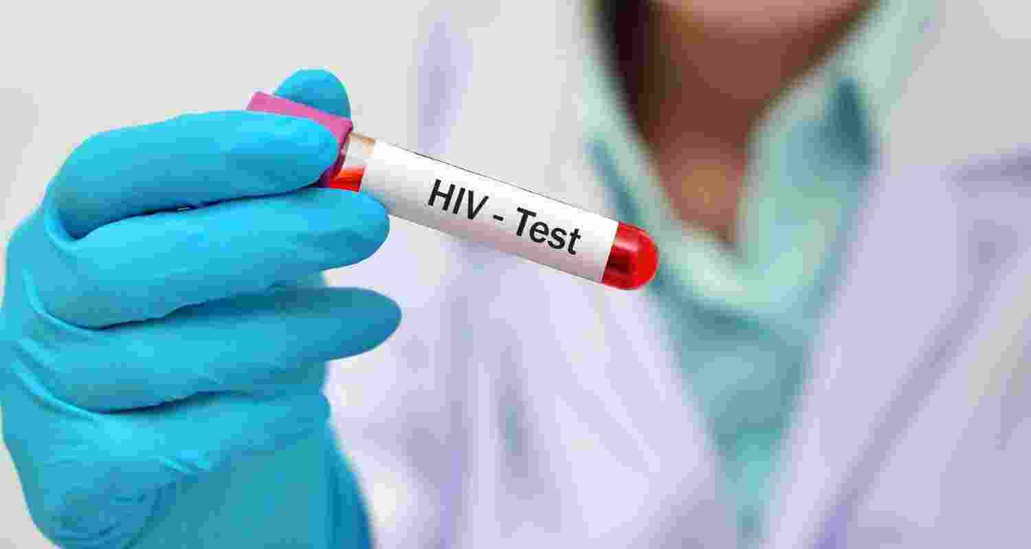 Health authorities report a rise in HIV cases in Burdwan district, with nearly 30 infections detected in the city; officials plan intensified awareness drives.