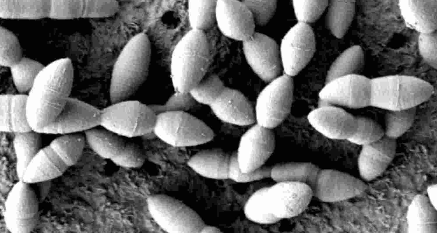 Japanese researchers find gut bacteria helps fight cancer