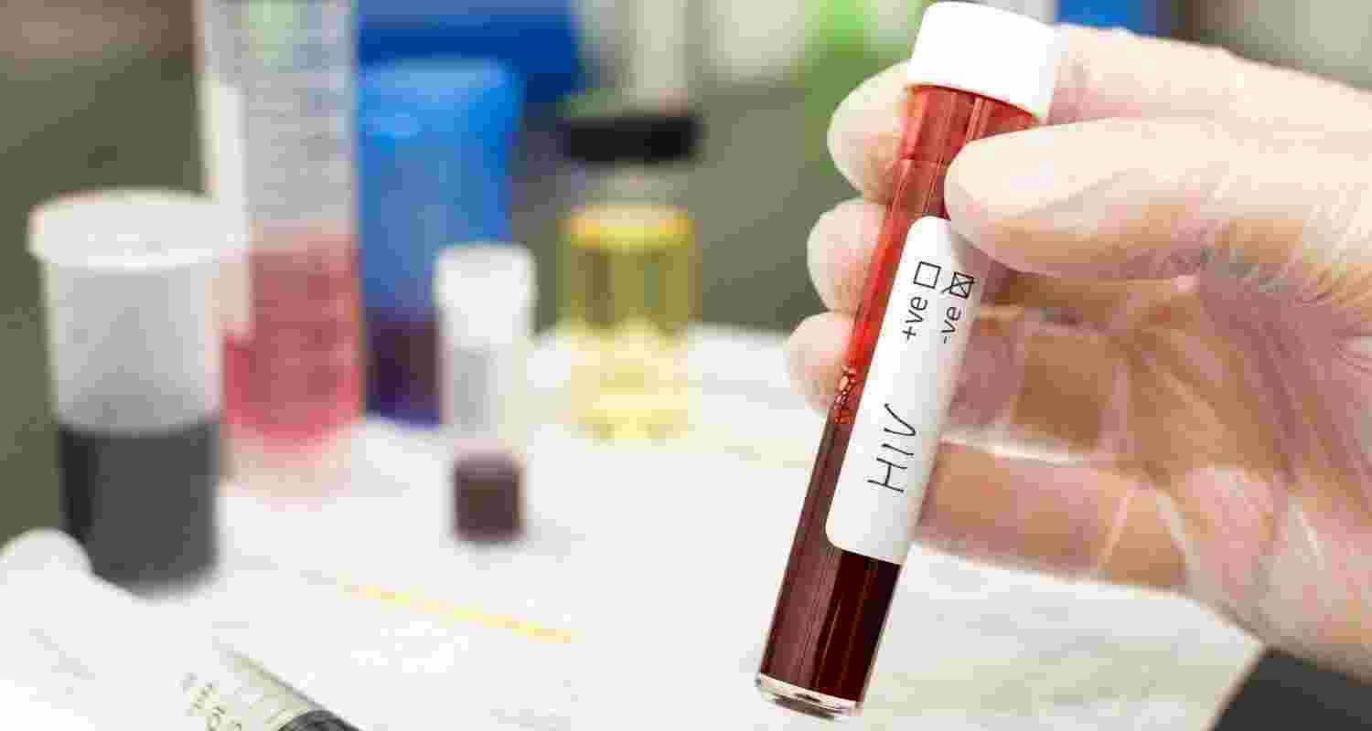 FIR lodged in HIV-infected blood transfusions case
