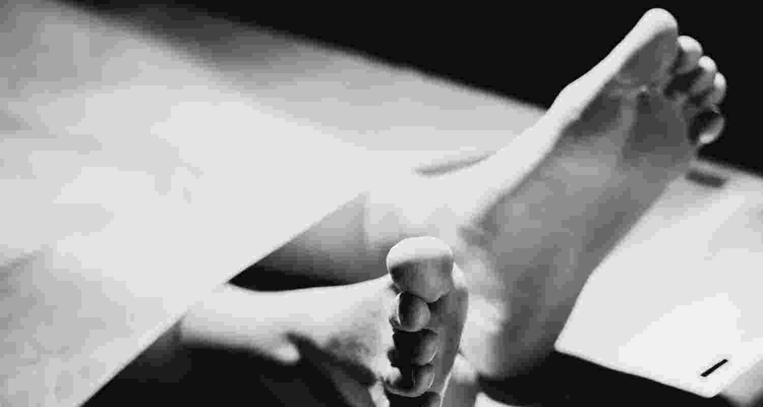 Representative Image. 