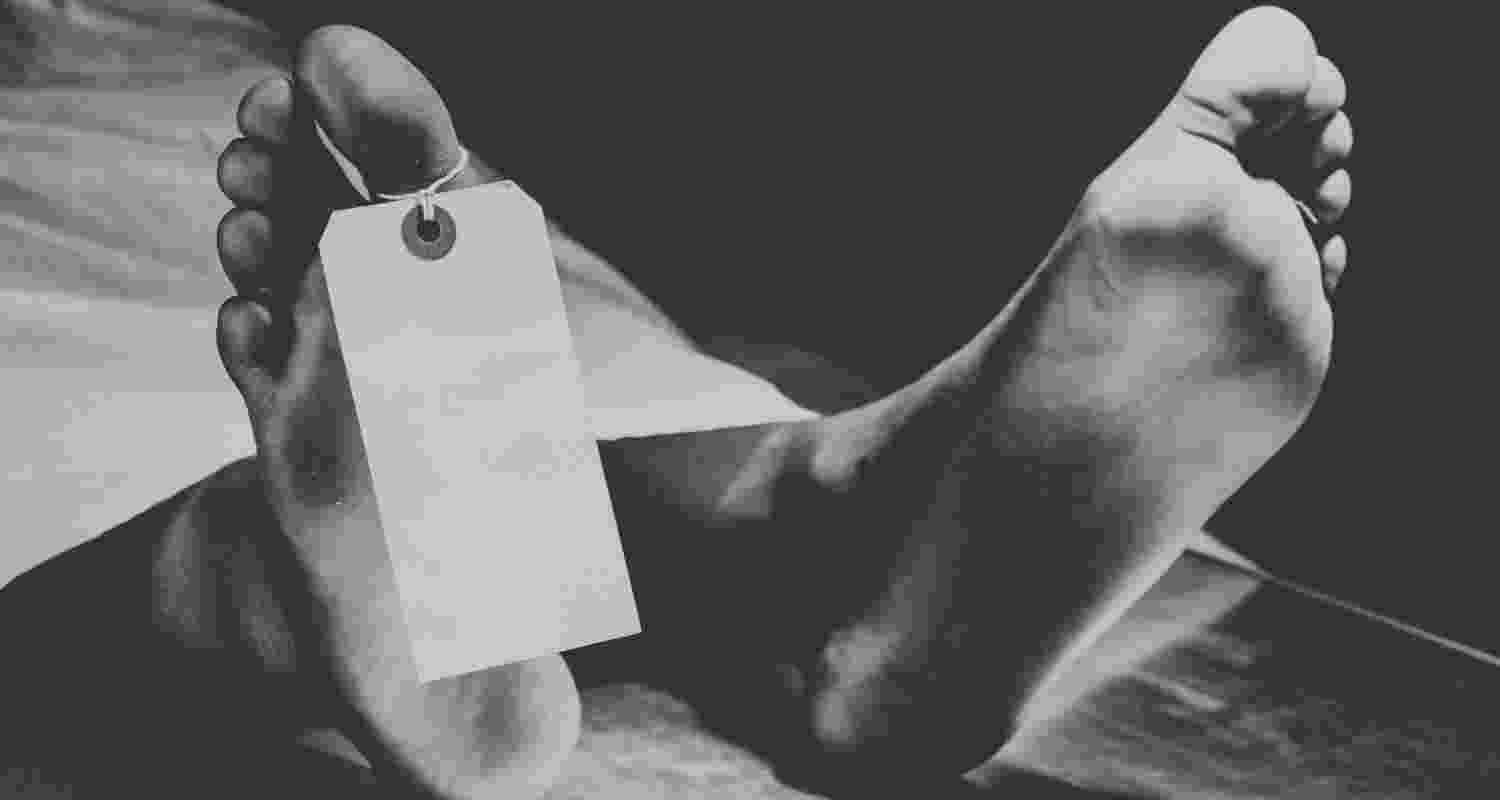 Representative Image. 