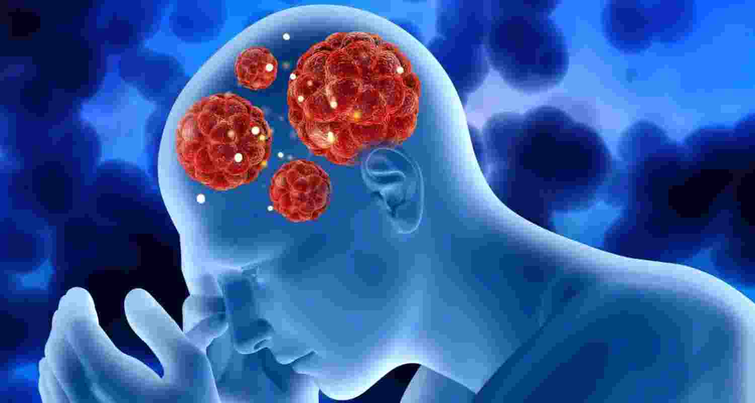 Kerala logs 67 brain-eating amoeba cases, 18 deaths reported in 2025