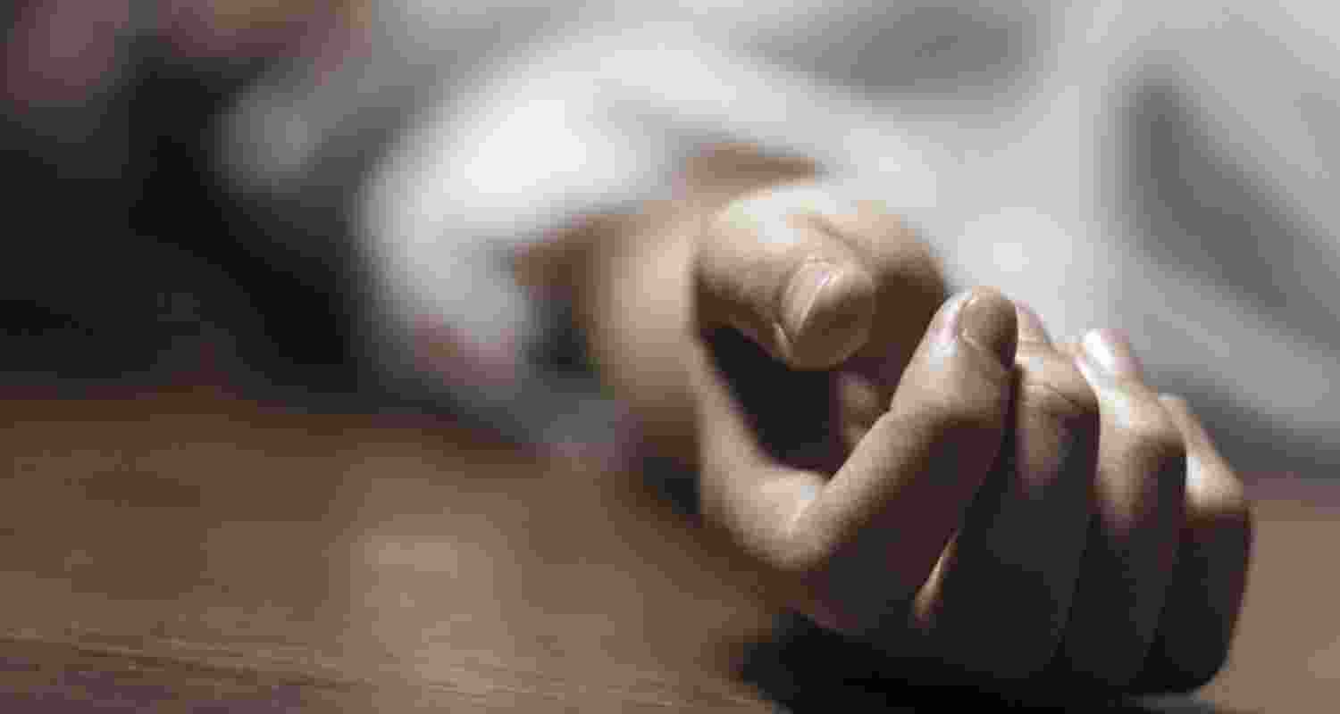 Representative Image