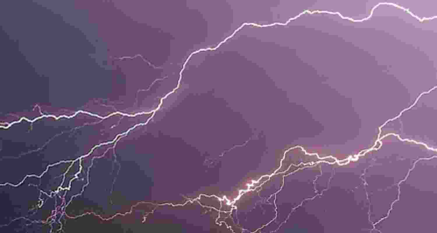 Representative Image. 