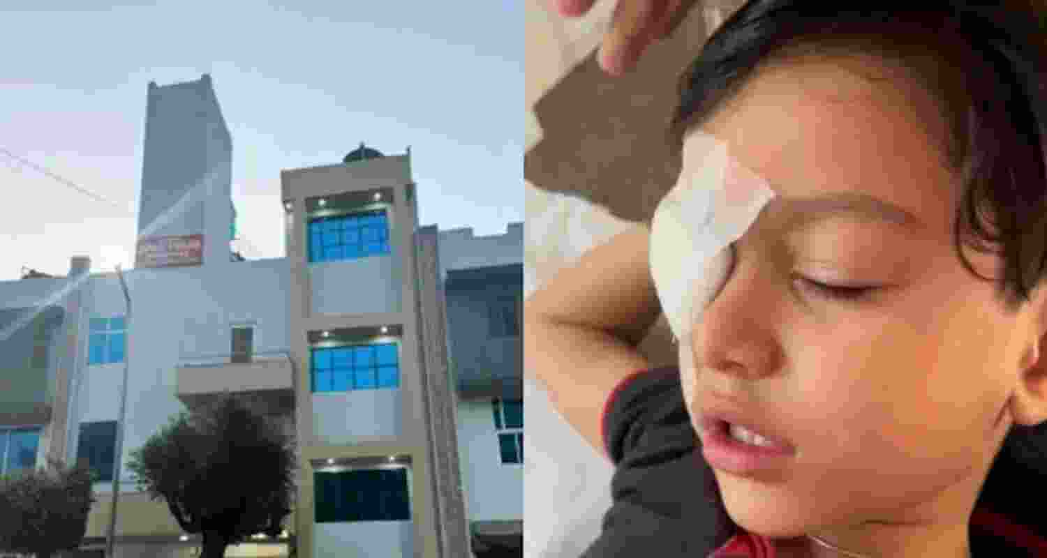 The seven year old boy was operated in the wrong eye.