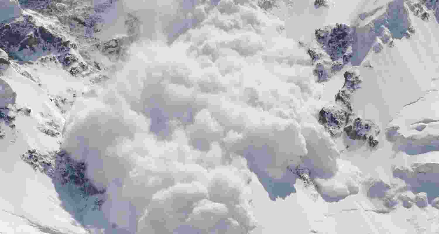 Representational image.