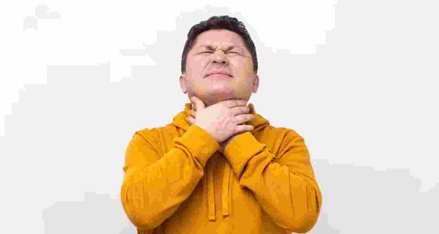 Representational image.