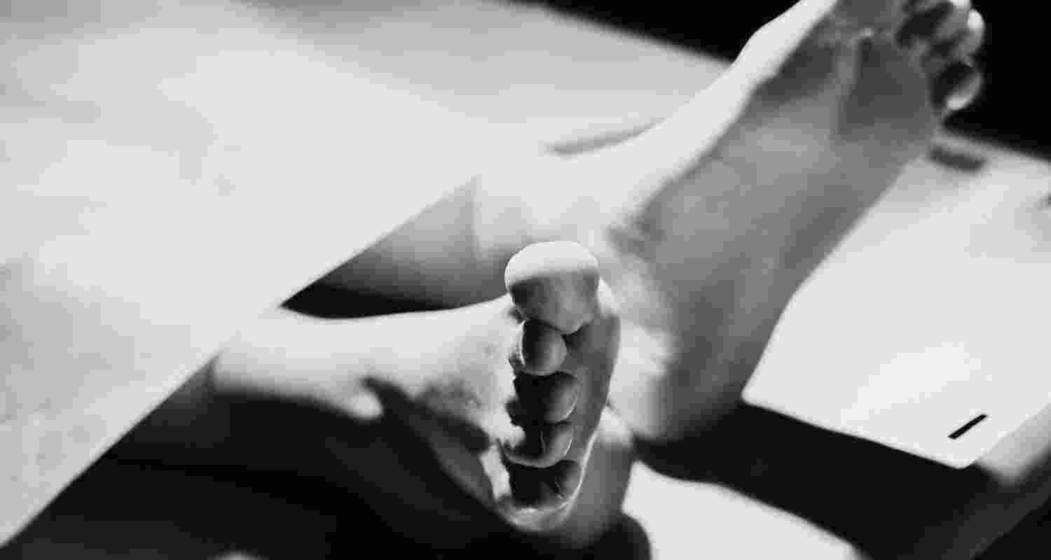 Representative Image. 