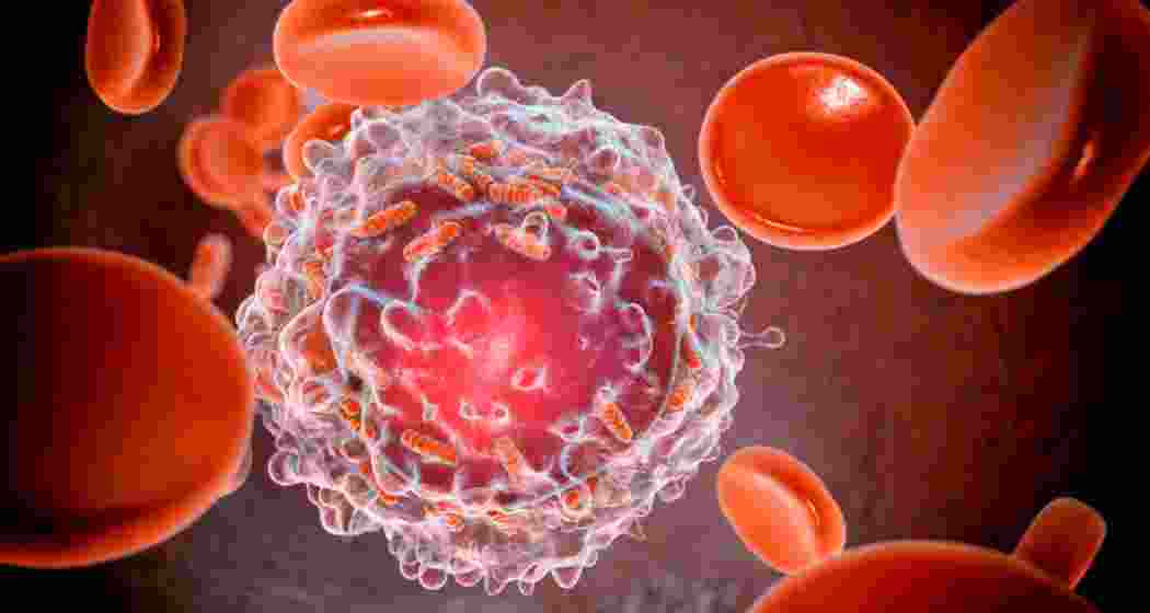 Image for representative use only. Image for representative use only.