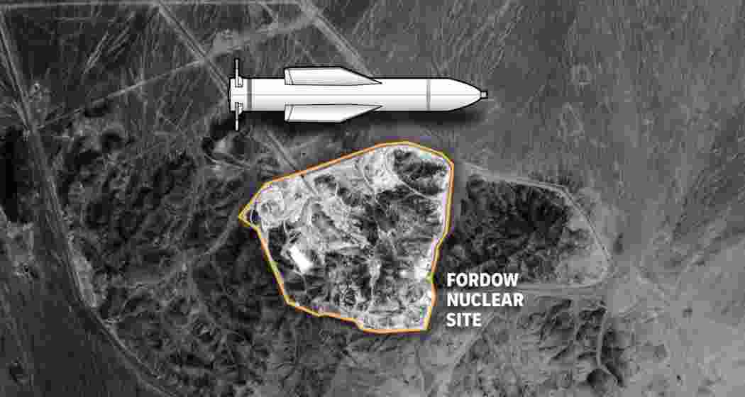 Representative image. Representative image.