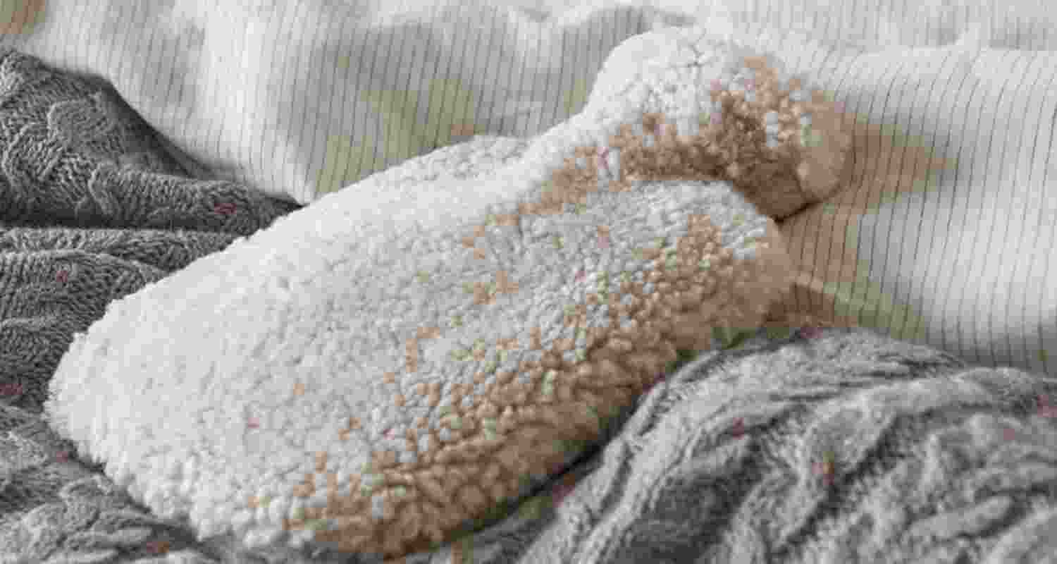 From toasted skin to burns: Hot water bottle hazards From toasted skin to burns: Hot water bottle hazards