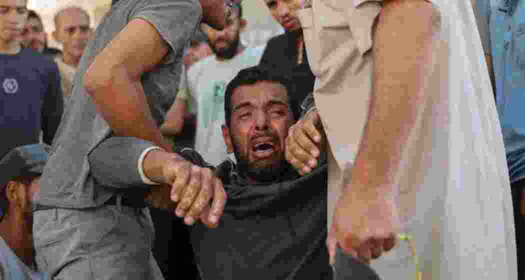 Representative image. Representative image.