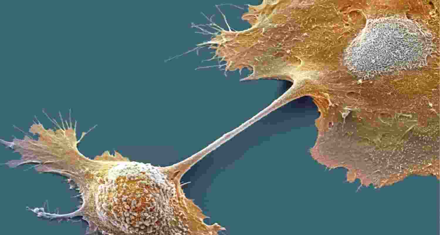 How daraxonrasib tamed ‘undruggable’ pancreatic cancer How daraxonrasib tamed ‘undruggable’ pancreatic cancer