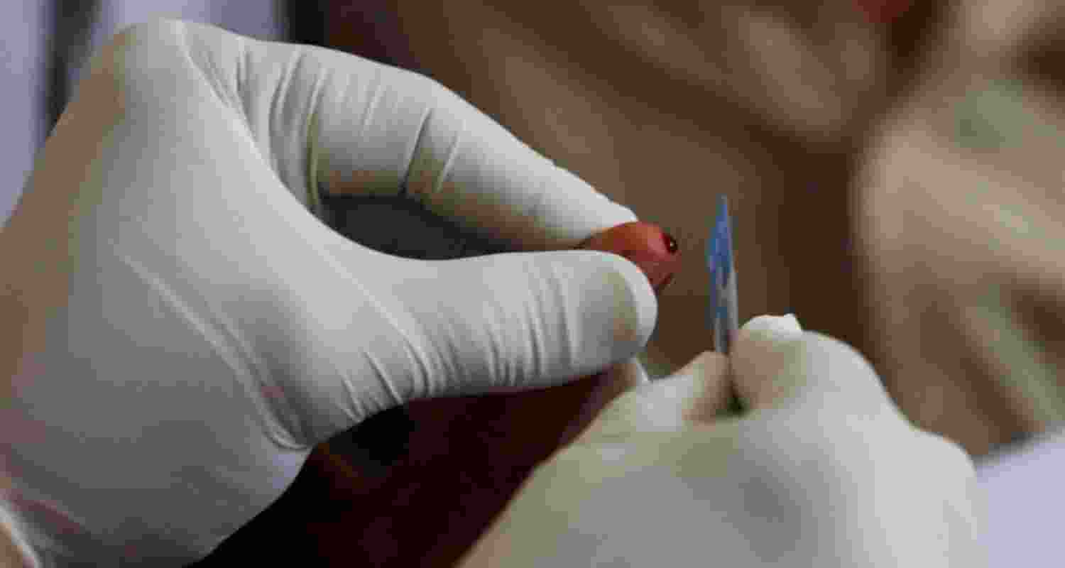 H1N1 cases on rise in Delhi-NCR during monsoon rains H1N1 cases on rise in Delhi-NCR during monsoon rains